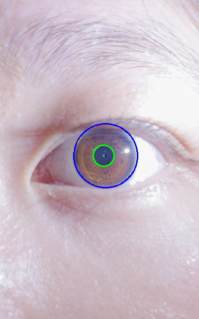 Close-up eye with a fitted blue iris circle and green pupil circle used for iris-grounded millimeter calibration